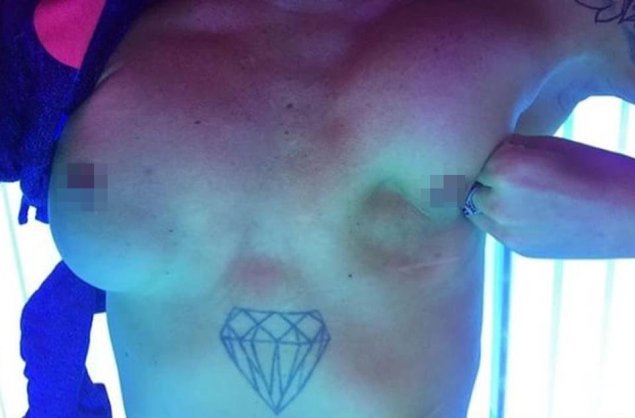 Сиськи импланты