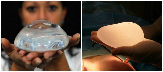 Маммопластика капсулярная контрактура