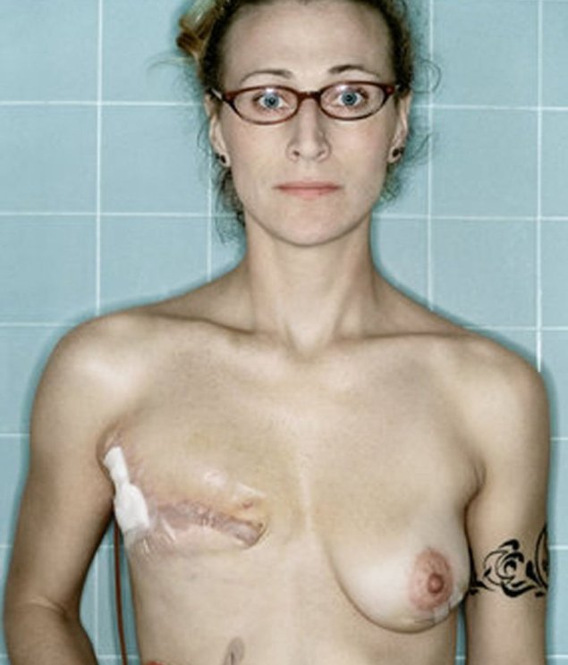 Некрасивая грудь