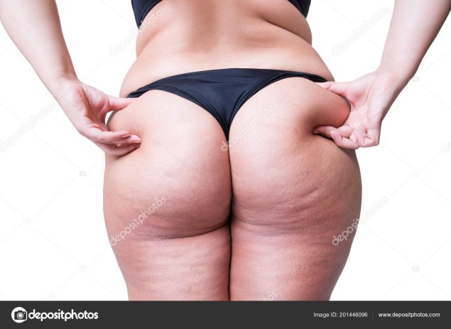 Большие целлюлитные ягодицы