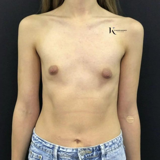 Для увеличения груди