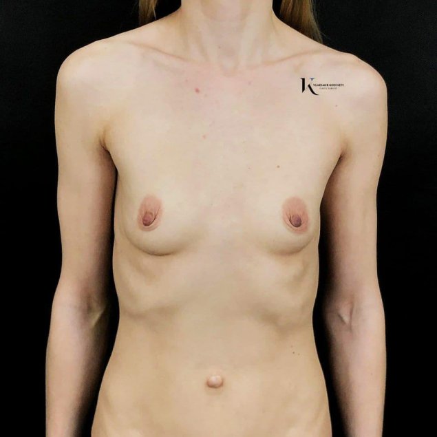 Сиськи нулевого размера