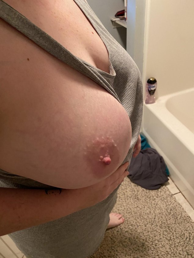 Соски при беременности