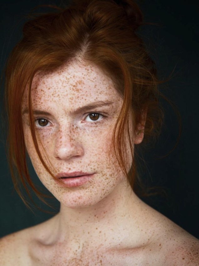 Селина скиндер веснушки