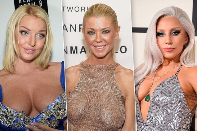 Леди гага пластика груди