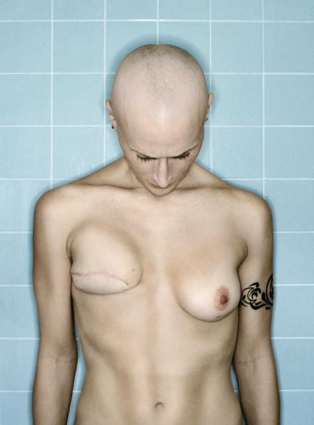 Необычная форма груди