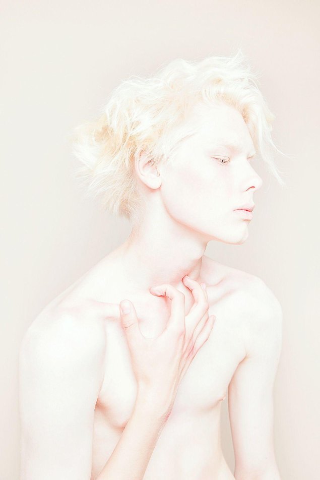 Игорь клепнев альбинос