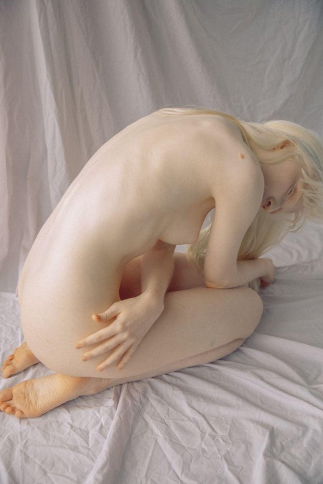 Анастасия жидкова альбинос