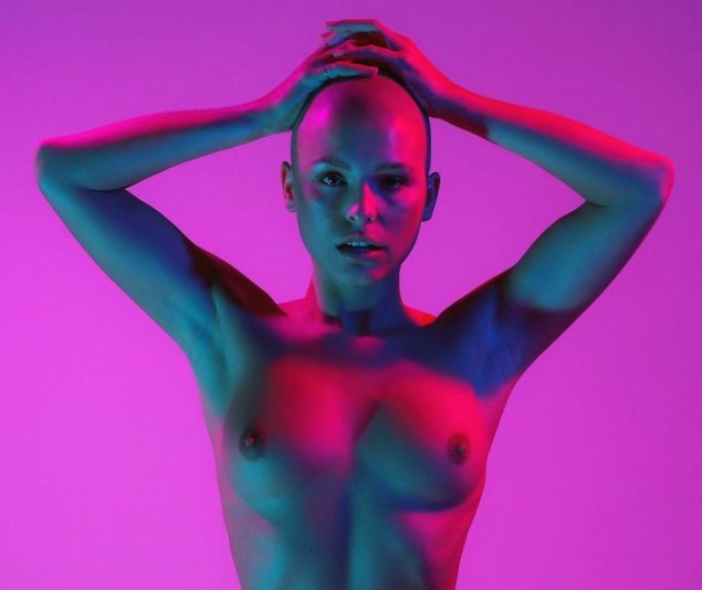 Лысая девушка