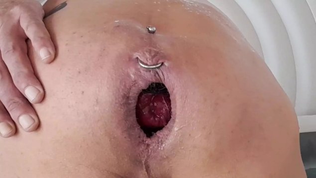 Анус фистинг