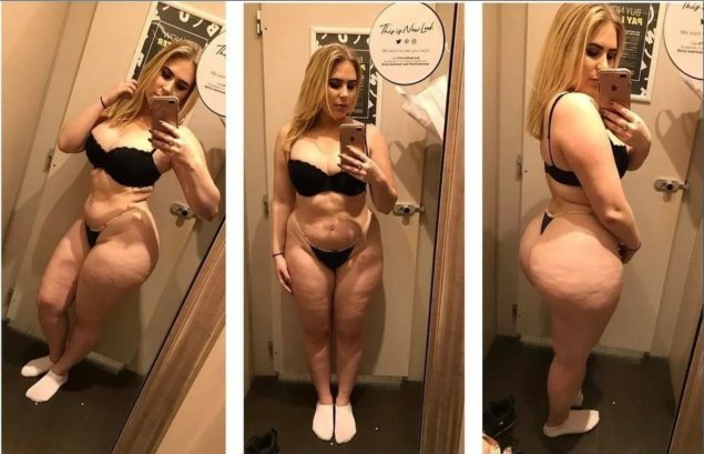 Девушка с целлюлитом