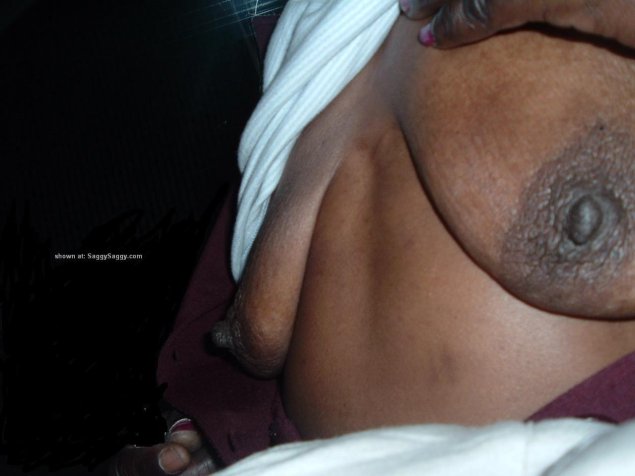 Уродливые сиськи