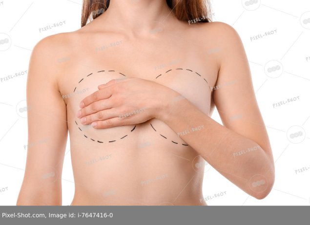 Woman with marks on her chest against white background